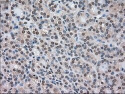 CTAG1B Mouse anti-Human, Clone: OTI3C9, liquid, TrueMAB 100 &mu;L; Unconjugated:Antibodies,
