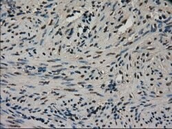 CTAG1B Mouse anti-Human, Clone: OTI3C9, liquid, TrueMAB 100 &mu;L; Unconjugated:Antibodies,