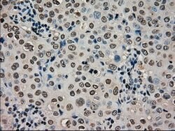 CTAG1B Mouse anti-Human, Clone: OTI3C9, liquid, TrueMAB 100 &mu;L; Unconjugated:Antibodies,