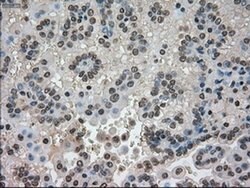 CTAG1B Mouse anti-Human, Clone: OTI3C9, liquid, TrueMAB 100 &mu;L; Unconjugated:Antibodies,