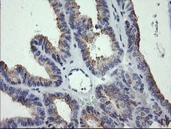 CTAG1B Mouse anti-Human, Clone: OTI2G2, lyophilized, TrueMAB 100 &mu;g;