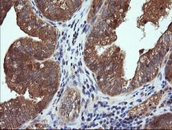 CTAG1B Monoclonal Antibody (OTI5H4), TrueMAB , OriGene 100 &mu;L; Unconjugated:Antibodies,