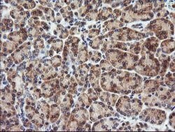 CTAG1B Monoclonal Antibody (OTI5H4), TrueMAB , OriGene 100 &mu;L; Unconjugated:Antibodies,