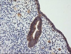 CTAG1B Monoclonal Antibody (OTI5H4), TrueMAB , OriGene 100 &mu;L; Unconjugated:Antibodies,