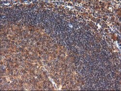 CTAG1B Monoclonal Antibody (OTI5H4), TrueMAB , OriGene:Antibodies:Primary