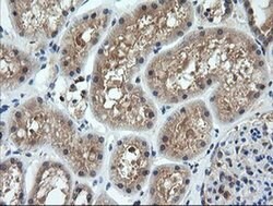 CTAG1B Monoclonal Antibody (OTI5H4), TrueMAB , OriGene:Antibodies:Primary