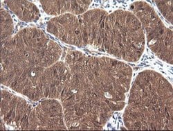 CTAG1B Monoclonal Antibody (OTI4C12), TrueMAB , OriGene 100 &mu;L; Unconjugated:Antibodies,