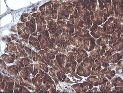 CTAG1B Monoclonal Antibody (OTI4C12), TrueMAB , OriGene 100 &mu;L; Unconjugated:Antibodies,