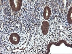CTAG1B Monoclonal Antibody (OTI4C12), TrueMAB , OriGene 100 &mu;L; Unconjugated:Antibodies,