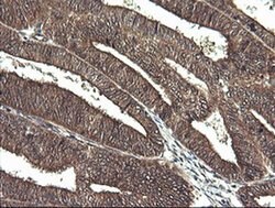 CTAG1B Monoclonal Antibody (OTI4C12), TrueMAB , OriGene 100 &mu;L; Unconjugated:Antibodies,