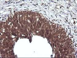 CTAG1B Monoclonal Antibody (OTI4C12), TrueMAB , OriGene 100 &mu;L; Unconjugated:Antibodies,