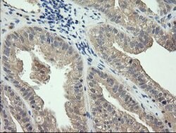 CTAG1B Monoclonal Antibody (OTI4C8), TrueMAB , OriGene:Antibodies:Primary