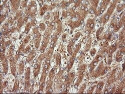 CTAG1B Monoclonal Antibody (OTI5E1), TrueMAB , OriGene 100 &mu;L; Unconjugated:Antibodies,