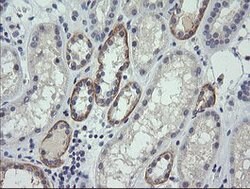 CTAG1B Mouse anti-Human, Clone: OTI9H6, lyophilized, TrueMAB 100 &mu;g;