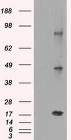 CTAG1B Mouse anti-Human, Clone: OTI3C9, liquid, TrueMAB 100 &mu;L; Unconjugated:Antibodies,
