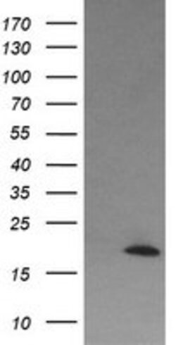 CTAG1B Mouse anti-Human, Clone: OTI2A10, lyophilized, TrueMAB 100 &mu;g;