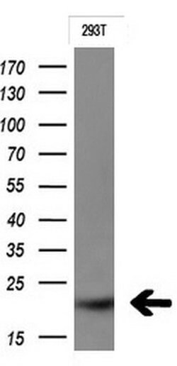 CTAG1B Mouse anti-Human, Clone: OTI2A10, lyophilized, TrueMAB 100 &mu;g;