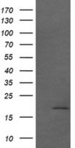 CTAG1B Mouse anti-Human, Clone: OTI2G2, lyophilized, TrueMAB 100 &mu;g;