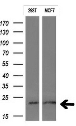 CTAG1B Mouse anti-Human, Clone: OTI2G2, lyophilized, TrueMAB 100 &mu;g;