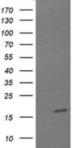 CTAG1B Mouse anti-Human, Clone: OTI2B4, lyophilized, TrueMAB 100 &mu;g;