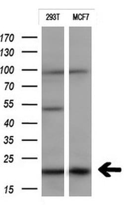 CTAG1B Mouse anti-Human, Clone: OTI2B4, lyophilized, TrueMAB 100 &mu;g;