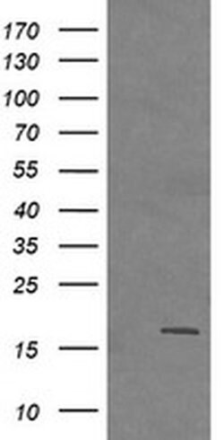 CTAG1B Monoclonal Antibody (OTI1C4), TrueMAB , OriGene:Antibodies:Primary