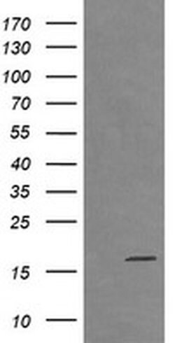 CTAG1B Monoclonal Antibody (OTI5H4), TrueMAB , OriGene 100 &mu;L; Unconjugated:Antibodies,