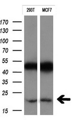 CTAG1B Monoclonal Antibody (OTI5H4), TrueMAB , OriGene 100 &mu;L; Unconjugated:Antibodies,