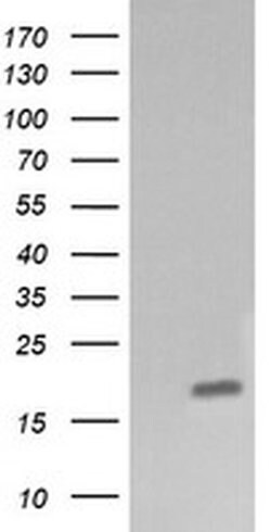 CTAG1B Monoclonal Antibody (OTI4C12), TrueMAB , OriGene 100 &mu;L; Unconjugated:Antibodies,