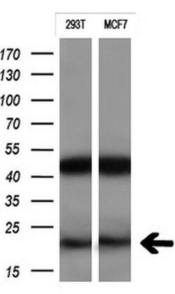 CTAG1B Monoclonal Antibody (OTI4C8), TrueMAB , OriGene:Antibodies:Primary