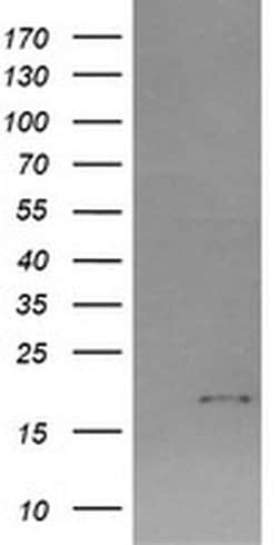CTAG1B Monoclonal Antibody (OTI5E1), TrueMAB , OriGene 100 &mu;L; Unconjugated:Antibodies,