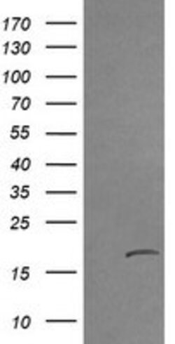 CTAG1B Mouse anti-Human, Clone: OTI9H6, lyophilized, TrueMAB 100 &mu;g;