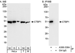 CTBP1 Rabbit anti-Human, Polyclonal, Bethyl Laboratories 100 &mu;l; Unlabeled:Antibodies,