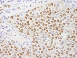 CTBP1 Polyclonal Antibody, Bethyl Laboratories 100 &mu;L; Unconjugated:Antibodies,