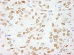 CTBP1 Polyclonal Antibody, Bethyl Laboratories 100 &mu;L; Unconjugated:Antibodies,