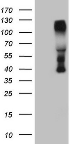 CTBP2 Monoclonal Antibody (OTI3G4), TrueMAB , OriGene:Antibodies:Primary