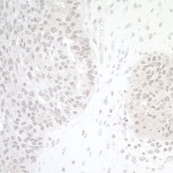 CTCF Rabbit anti-Human, Mouse, Polyclonal, Bethyl Laboratories 100 &mu;L;