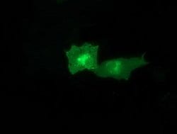 CTDSP1 Monoclonal Antibody (OTI1D3), TrueMAB , OriGene 30 &mu;L; Unconjugated:Antibodies,