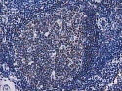 CTDSP1 Monoclonal Antibody (OTI1B5), TrueMAB , OriGene 100 &mu;L; Unconjugated:Antibodies,