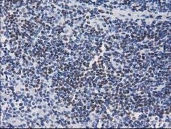 CTDSP1 Mouse anti-Human, Clone: OTI1B5, lyophilized, TrueMAB 100 &mu;g;