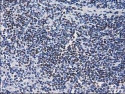 CTDSP1 Monoclonal Antibody (OTI1B5), TrueMAB , OriGene 100 &mu;L; Unconjugated:Antibodies,