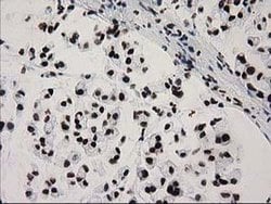 CTDSP1 Mouse anti-Human, Clone: OTI1G1, liquid, TrueMAB 100 &mu;L; Unconjugated:Antibodies,
