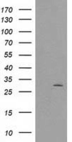 CTDSP1 Mouse anti-Human, Clone: OTI1B5, lyophilized, TrueMAB 100 &mu;g;