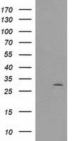 CTDSP1 Monoclonal Antibody (OTI1B5), TrueMAB , OriGene 100 &mu;L; Unconjugated:Antibodies,
