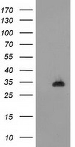 CTDSP1 Monoclonal Antibody (OTI1A7), TrueMAB , OriGene 100 &mu;L; Unconjugated:Antibodies,