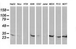 CTDSP1 Monoclonal Antibody (OTI1D3), TrueMAB , OriGene 30 &mu;L; Unconjugated:Antibodies,