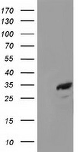 CTDSP1 Monoclonal Antibody (OTI1C3), TrueMAB , OriGene:Antibodies:Primary