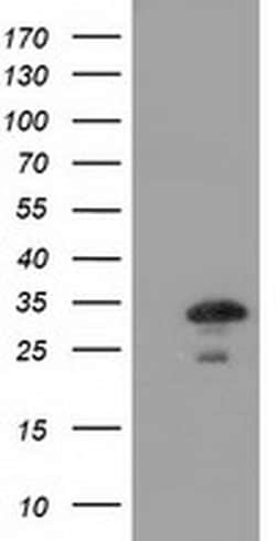 CTDSP1 Mouse anti-Human, Clone: OTI1G1, liquid, TrueMAB 100 &mu;L; Unconjugated:Antibodies,