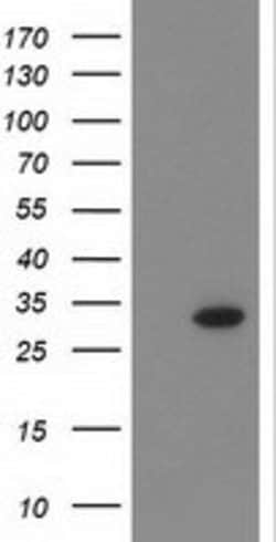 CTDSP1 Mouse anti-Human, Clone: OTI1F4, lyophilized, TrueMAB 100 &mu;g;