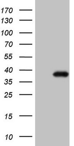 CTDSP2 Monoclonal Antibody (OTI7F5), TrueMAB , OriGene 30 &mu;L; Unconjugated:Antibodies,